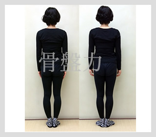 ビフォーアフター